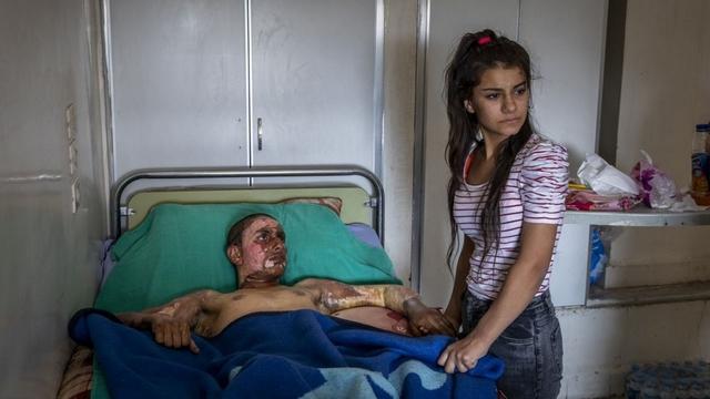 Injured Kurdish Fighter Receives Hospital Visit, by Ivor Prickett - Read Photos